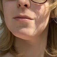 Acvalens Meztelen