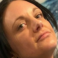 amputeedarling Meztelen