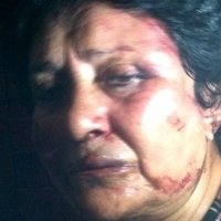 Ana Luisa Pardo Meztelen