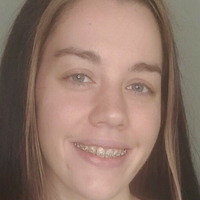 bracefacefree Meztelen