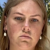 Chynnaclair Meztelen