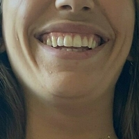 colette_duval Meztelen