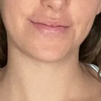 Emmashore Meztelen