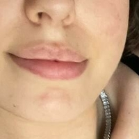 fitfifi Meztelen