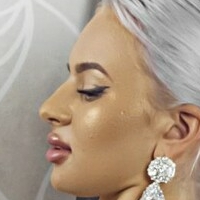Florina Meztelen