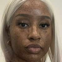 freckledn Meztelen