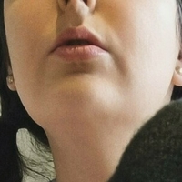 frillymillyx Meztelen