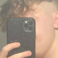 ftmtwinkty Meztelen