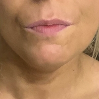 Holytits Meztelen