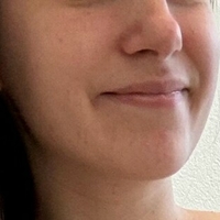 HoneyandBear Meztelen
