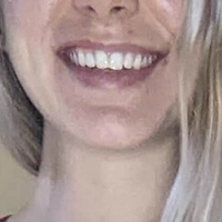 hotyoga Meztelen