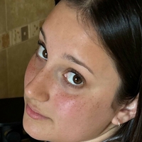 keshaortegafree Meztelen