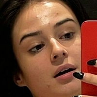 Lauraysergii Meztelen