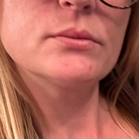 littlemiss19891 Meztelen