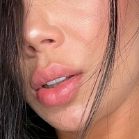 lopezeli Meztelen