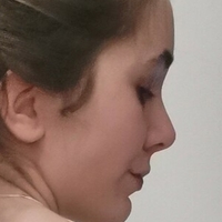 Lovinghare Meztelen