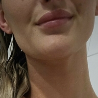 Marie Müller Meztelen