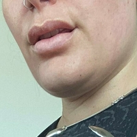 squishy_bae Meztelen