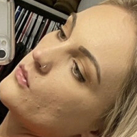 xoxalexis Meztelen